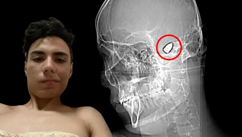 Kafasında Patlayan Düşünceler: Zihin Sağlığı Üzerine Dikkat Çeken Gerçekler